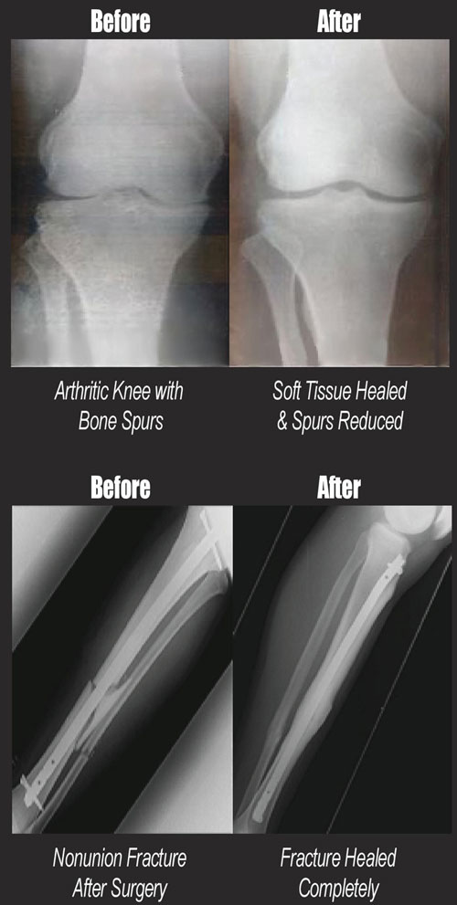 PEMF Products - Before And After
